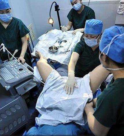 自己的胚胎想找人代怀,揭秘试管婴儿取卵抽精全过程