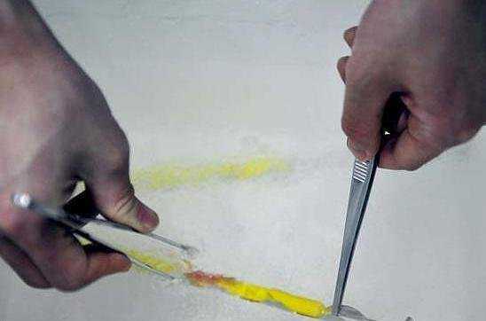 自己的胚胎想找人代怀,揭秘试管婴儿取卵抽精全过程